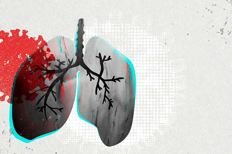 9 Lebensmittel für eine gesunde Lunge