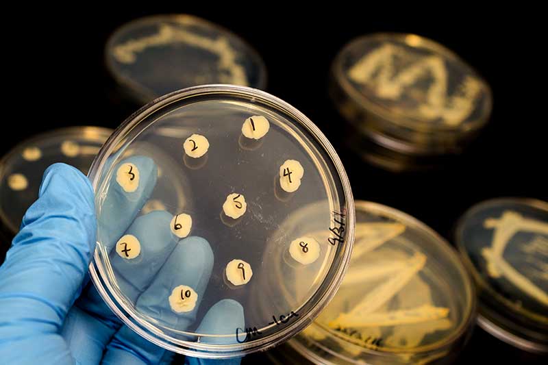 Diese 13 Faktoren schwächen unser Mikrobiom